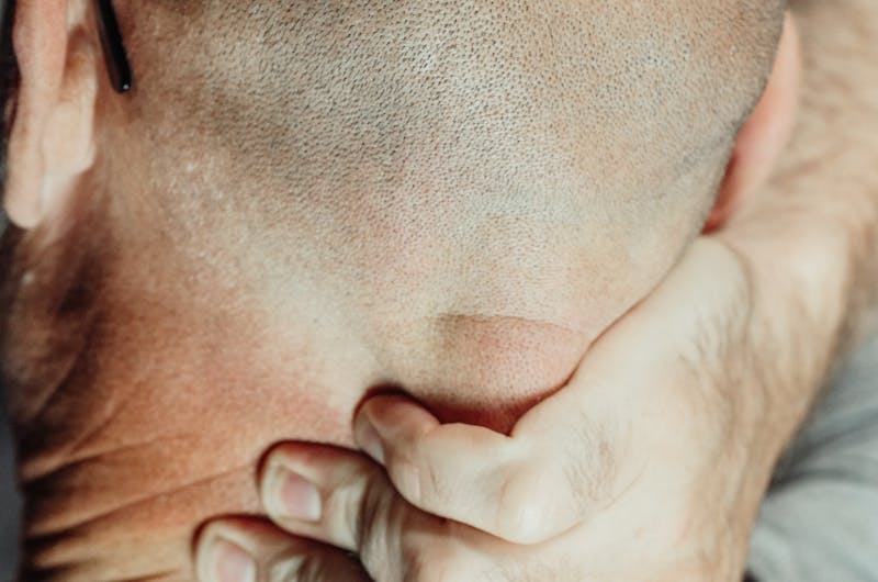 A bald man holding his neck to soothe discomfort, highlighting neck pain relief methods.